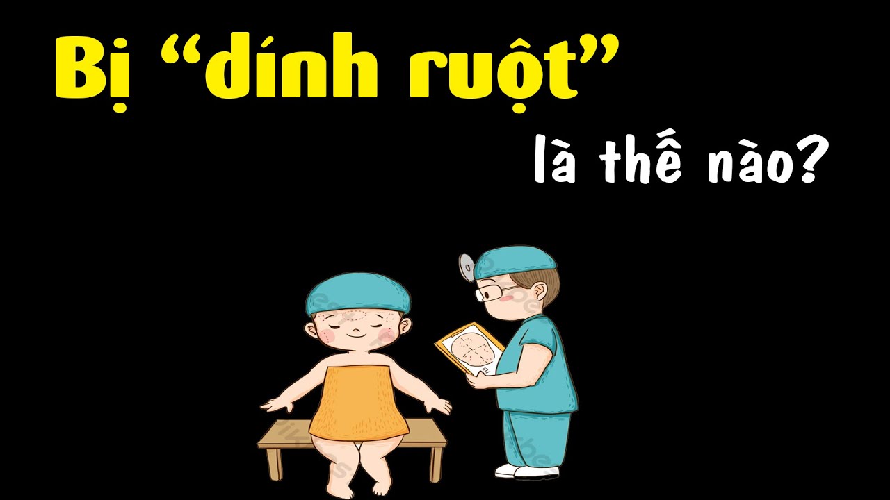 Bị dính ruột là thế nào? Tại sao phải tập đi để không dính ruột? - YouTube