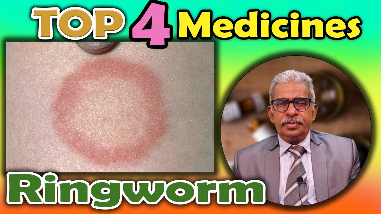 Top 4 Homeopathy Medicines For Ringworm Dr P S Tiwari Youtube