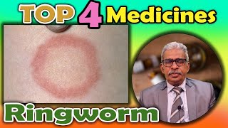 Top 4 - Homeopathy Medicines for Ringworm - Dr P. S. Tiwari