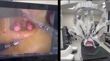 Robotic-Assisted Radical Prostatectomy Training - 3D models