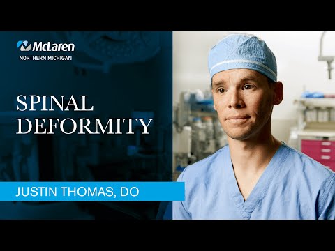 Spinal Deformity video thumbnail