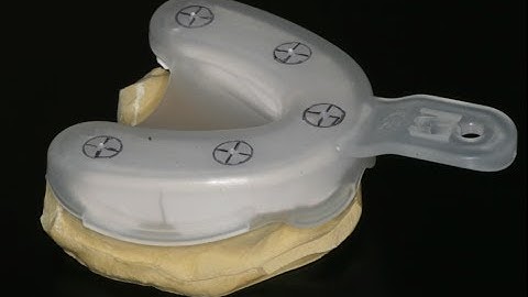 Surgical Guide Scanning Protocol: In-Office CBCT
