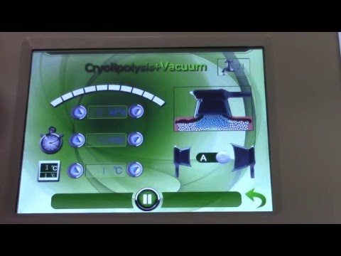Auctioning Used NBW-C325 Cryolipolysis Lipo Slimming Cavitation Attachments - YouTube