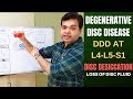 Degenerative Disc Disease (DDD) L4 L5, L5 S1-Disc Desiccation- Disc Degeneration Disease Treatment