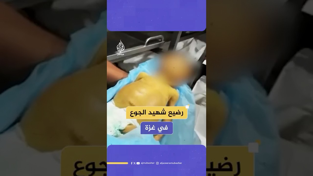 مستشفى ناصر الطبي بخان يونس يعلن وفاة الطفل فهد المصري البالغ من العمر 6 أشهر