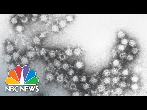 Enterovirus D-68: What You Need To Know | NBC News