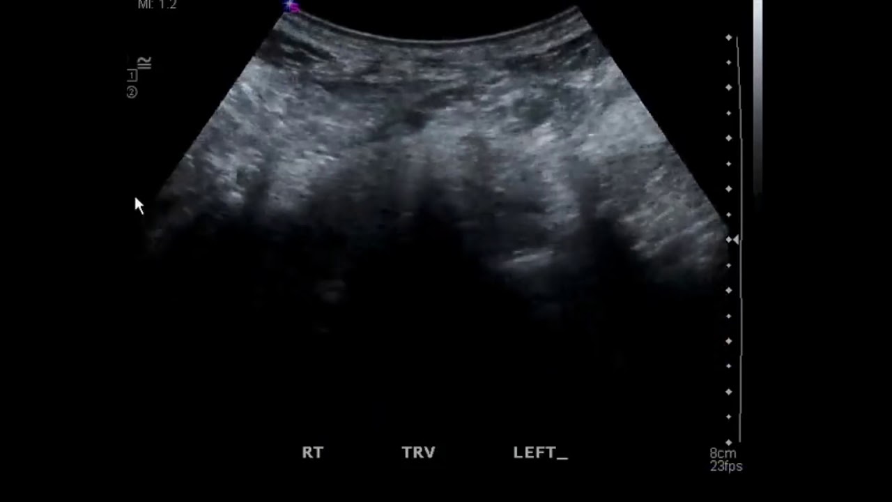 Rein En Fer A Cheval YouTube Rein En Fer A Cheval YouTube