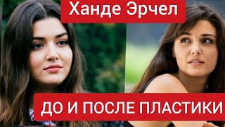 Хандэ Эрчел До И После Пластики