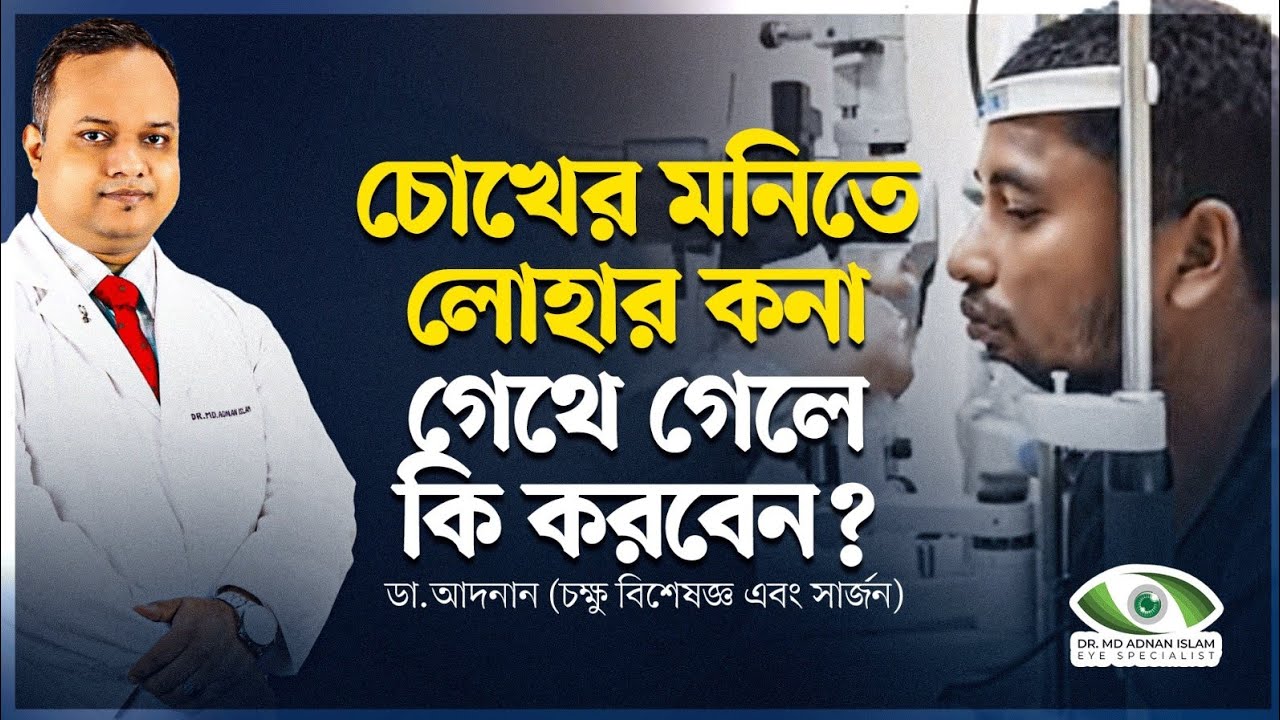 চোখের মনিতে লোহার কনা গেথে গেলে কি করবেন??? ডা.আদনান (চক্ষু বিশেষজ্ঞ এবং সার্জন)