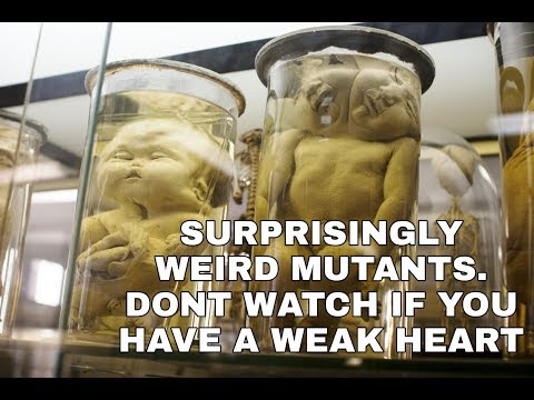 Video: Museum ng Medical Oddities, Taxidermy at Anatomy