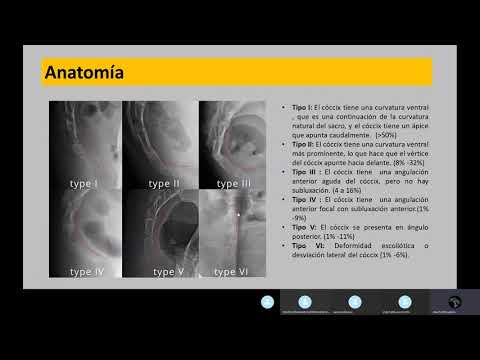 Vídeo: Quiste De Coxis: Causas, Síntomas, Diagnóstico, Tratamiento, Rehabilitación