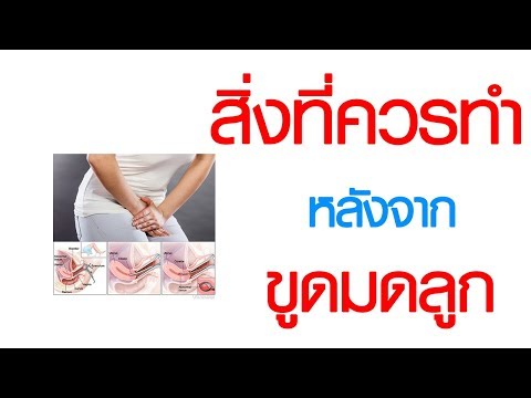 พบหมอเสรี ตอนที่ 282 : สิ่งที่ควรทำ หลังจากขูดมดลูก