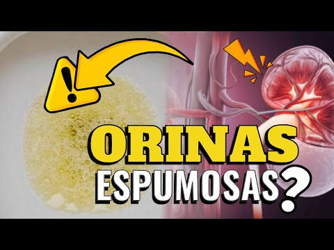 CUIDADO ⚠️ ¿ORINAS