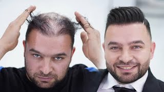 Thinning Haircut Transformation l Makeover for special Occasion