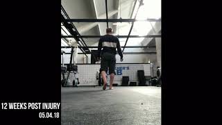 Rehabiliation Achilles Tendon Ruptur Crossfitter