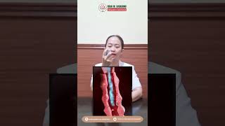 Use of inhalers.