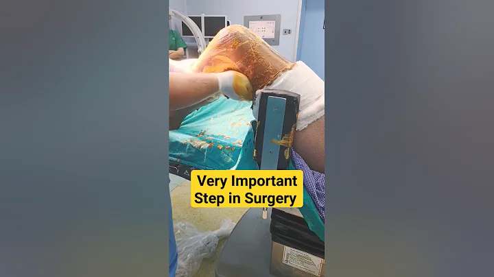 Most💯 Important Step Before any Procedure 🔥 - DayDayNews