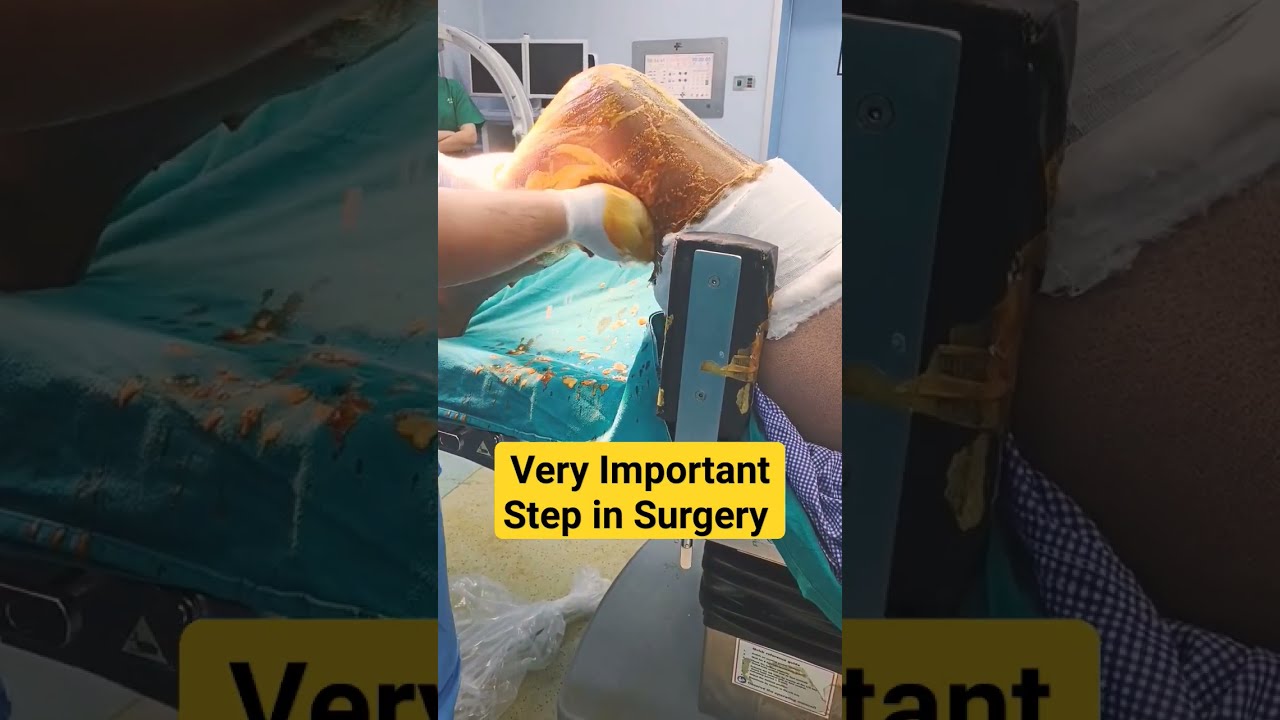 Most Important Step Before Any Procedure 
