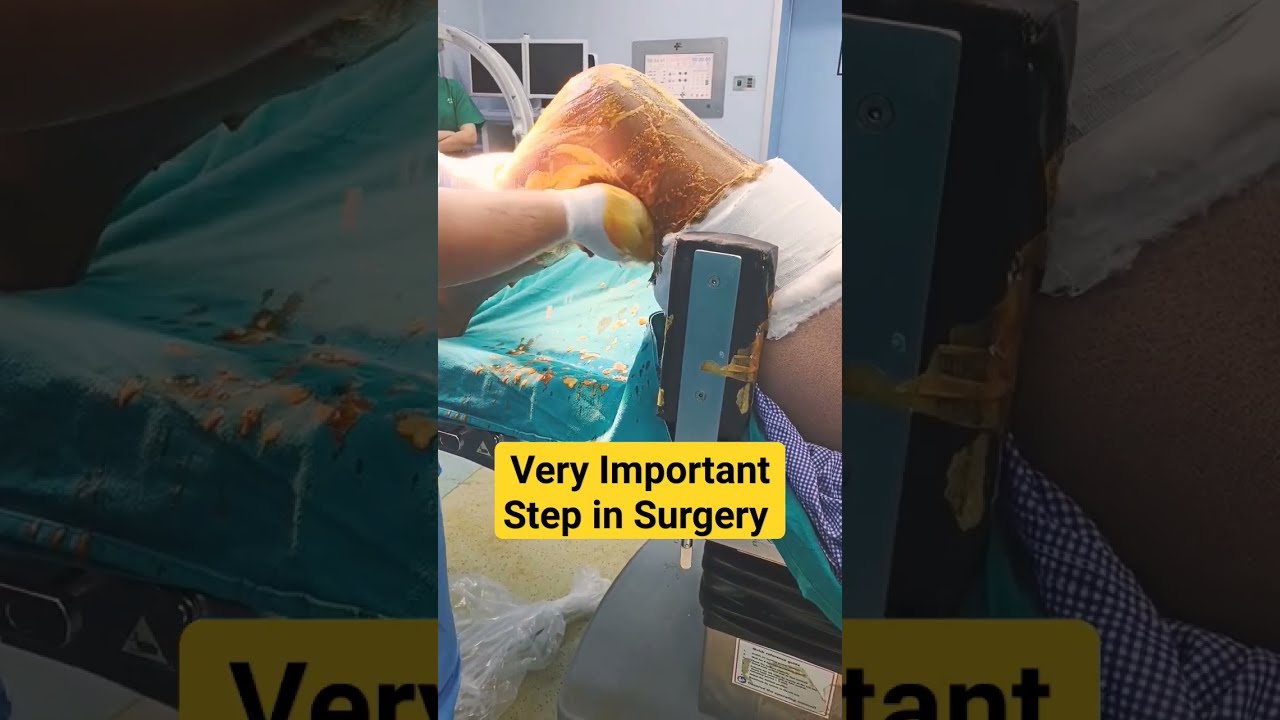 Most Important Step Before any Procedure 