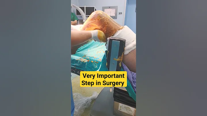 Most💯 Important Step Before any Procedure 🔥 - DayDayNews