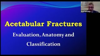 Acetabular Fractures ( Prof. Mohamed Elashhab ) screenshot 5