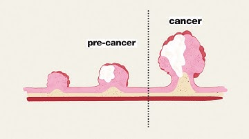 Colorectal cancer screening