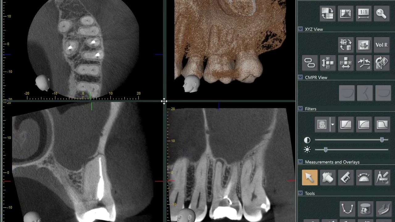Tutorial básico One Volume Viewer (J Morita)