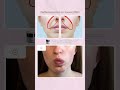 Избавляемся от НОСОГУБКИ УЗ #shorts #рек #уход #носогубка