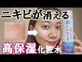 【乾燥肌必見】ニキビが消える最強保湿成分「プラセンタ」を含む化粧水を紹介。