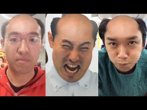 これが数年後の姿！？ハゲ頭に変身「baldbooth」