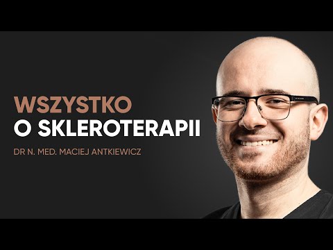 Skleroterapia – najczęstsze pytania