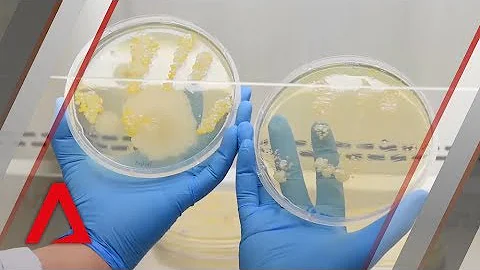 This is what the bacteria on your hands looks like under a microscope