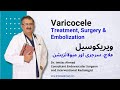Varicocele embolizationed dr imtiaz answers your questions