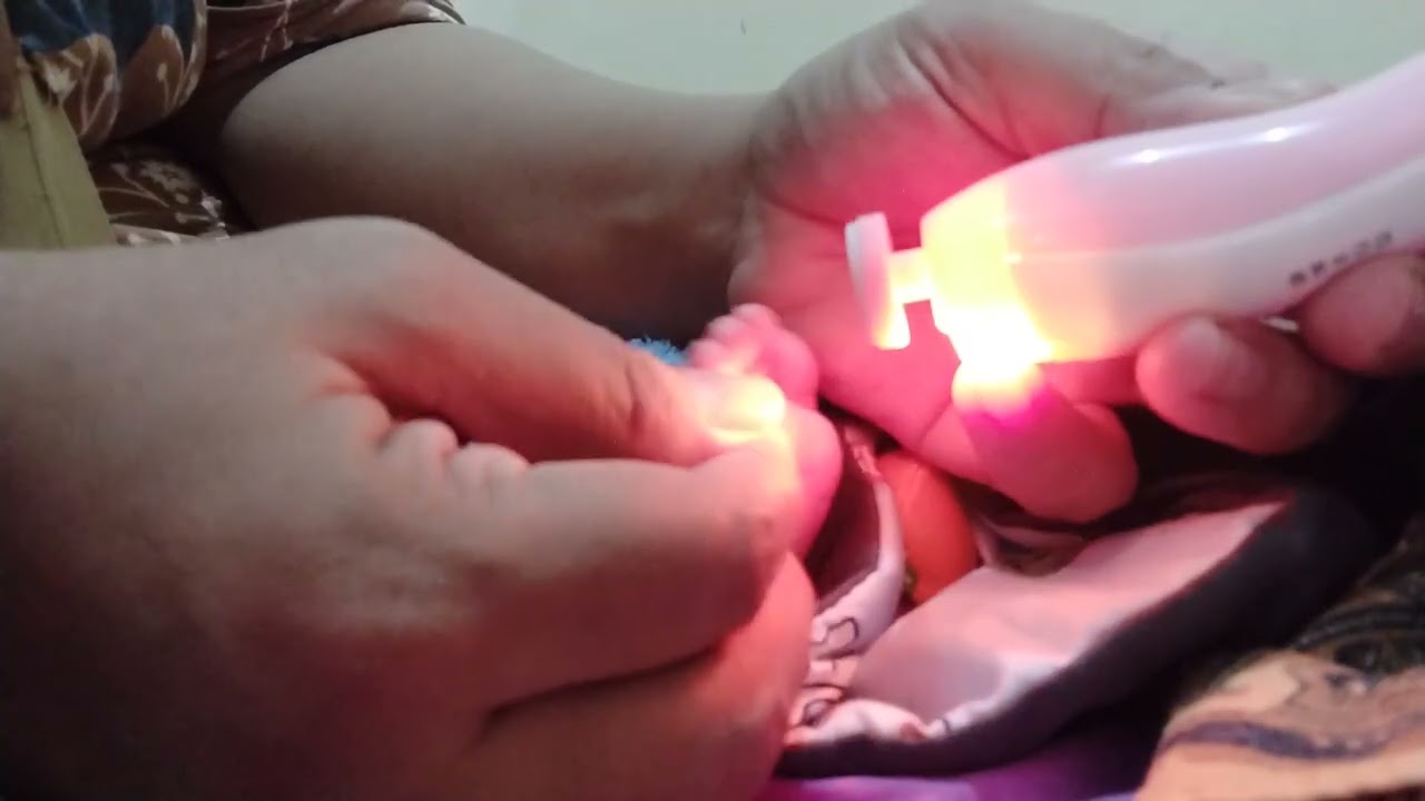 Potong kuku kaki ade aulia dulu