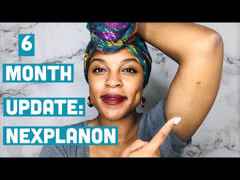 Are Keto Gummies Available in Stores? The Quest for Convenience