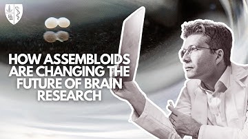 How assembloids are changing the future of brain research