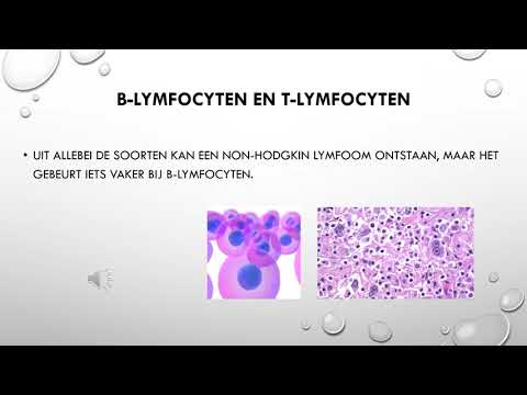 Video: Verschil Tussen Lymfoom En Non-Hodgkin-lymfoom