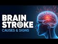 Brain Stroke: Causes And Signs | Medicover Hospitals