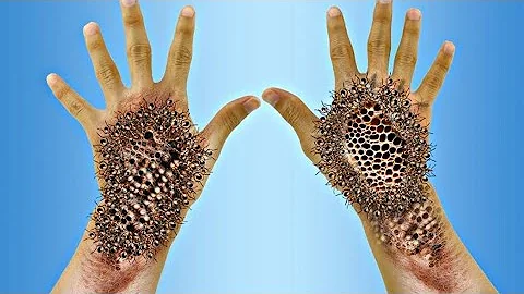 [ASMR] Remove The Cockroach From Between Chovy's Fingers