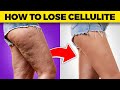 How to Lose Cellulite on Thighs & Buttocks Fast! | Dr Berg