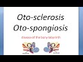 ENT Otosclerosis Part 1 OtoSpongiosis van der Hoeve syndrome Blue mantles TYPE Stapedial