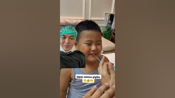 Cara cabut gigi yg sering dilakukan saat kita kecil dulu 😅