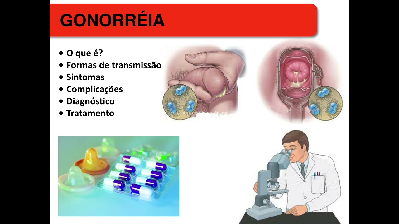papiloma virus o que e