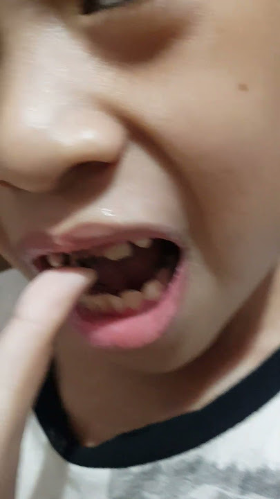 Brush your teeth | sikat gigimu | akibat malas gosok gigi