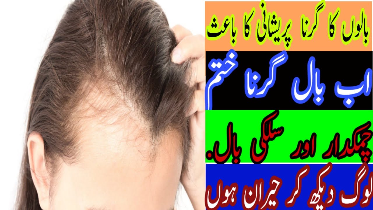 Stop Hair Fall In 1 Month 100 Natural Effective Home Remedy