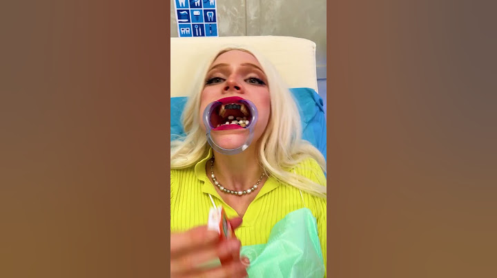 Wypadły mi zęby 😨 Dentysta Prank #komedia #śmieszne #skits #szorty