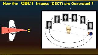 implant planning using CBCT by Dr  Khalid Ekram