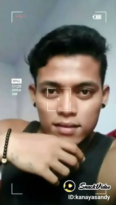 Viral