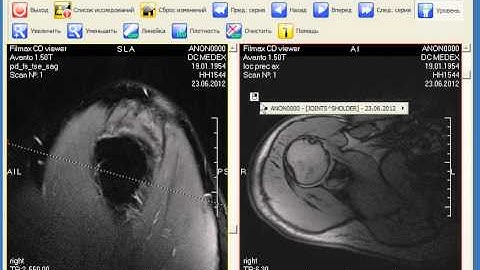 CD DVD first video FLV