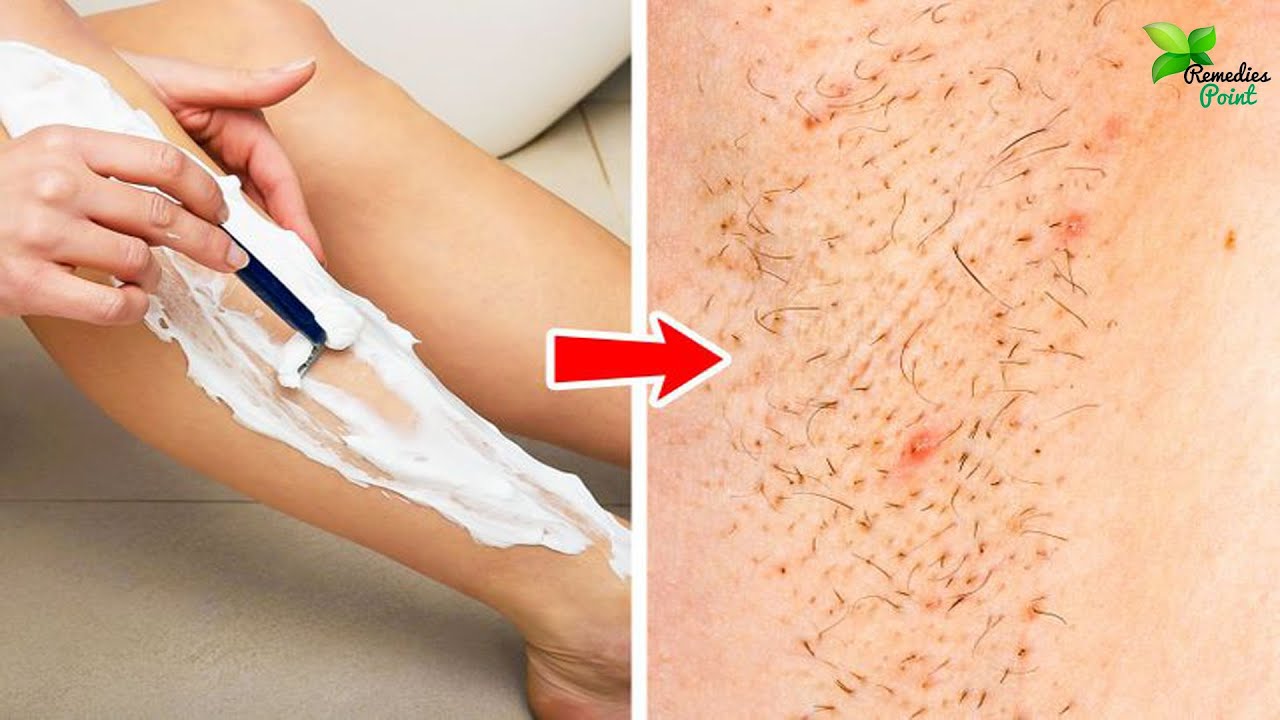 How to Remove Body Hair Permanently at Home Naturally For Female - YouTube